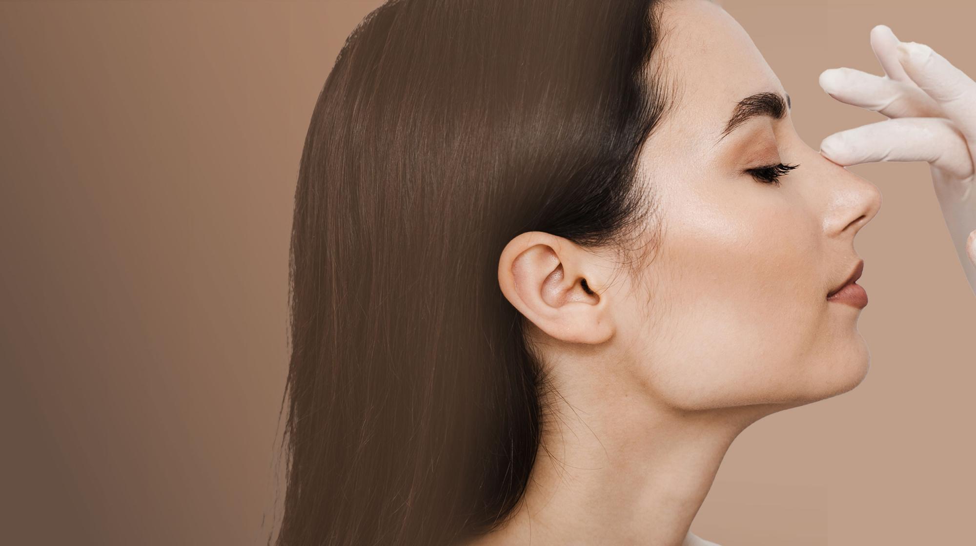 Rhinoplasty
